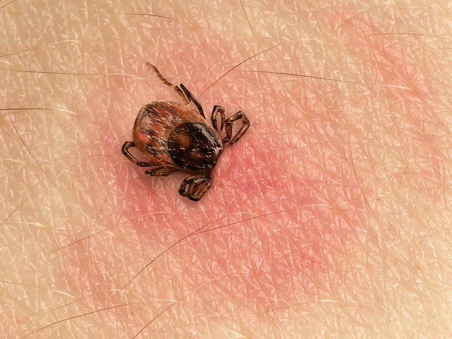 Lyme Disease and also the Debate That Surrounds It